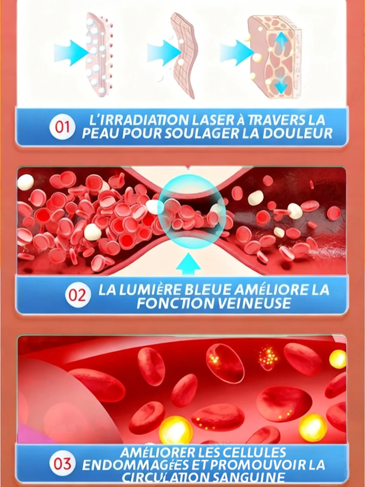 Stylo Laser Anti-Varices - Traitement des Varicosités