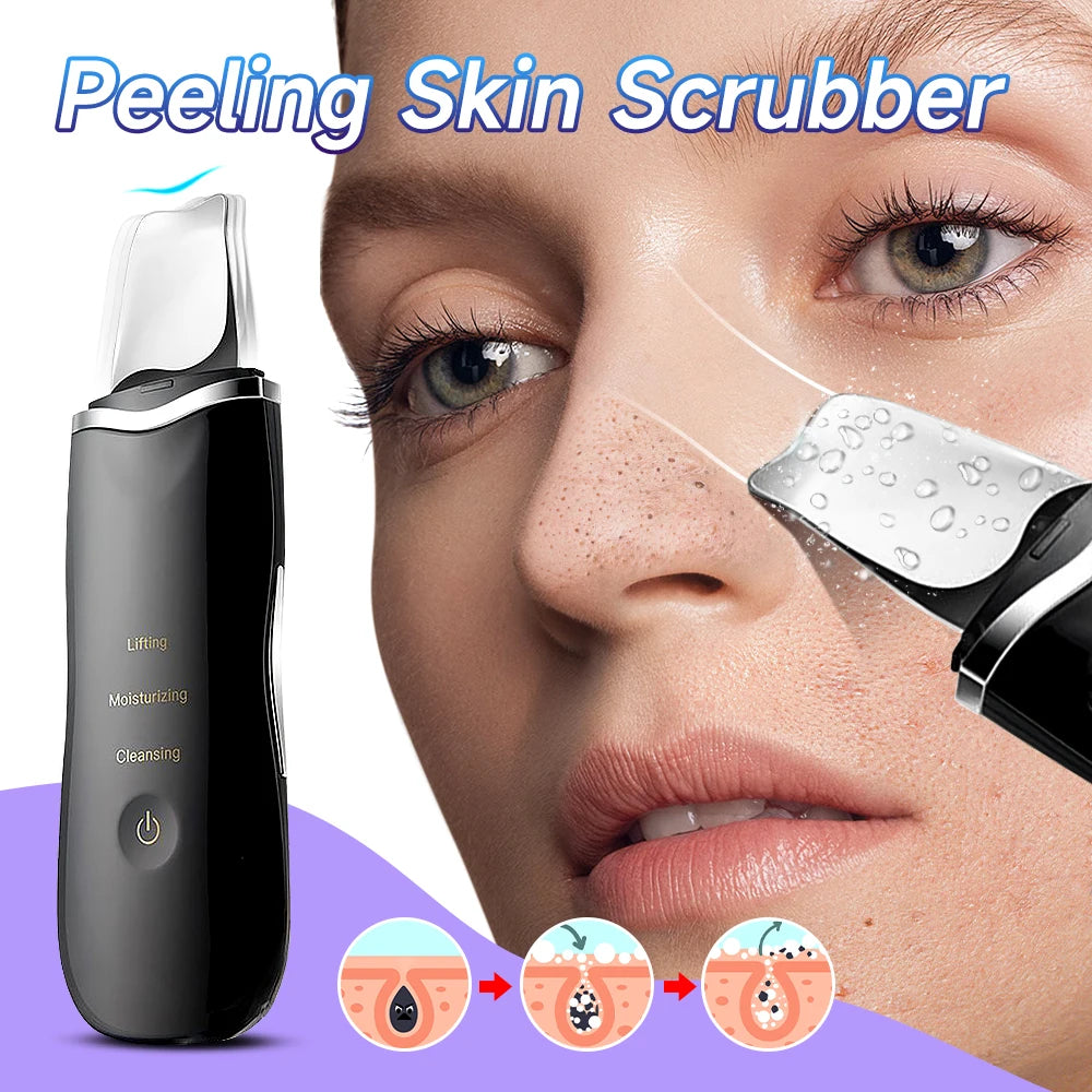 Ultrasonic Cleansing Spatula - Anti-Blackhead & Peeling
